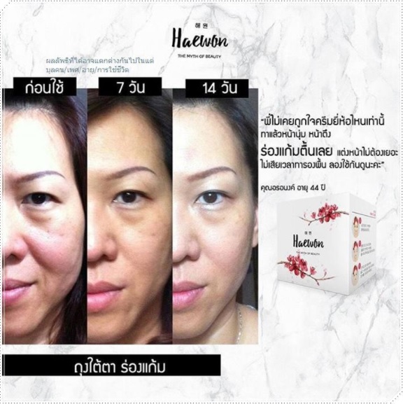  HAEWON ESSENCE รีวิว, ครีมแฮวอน รีวิว