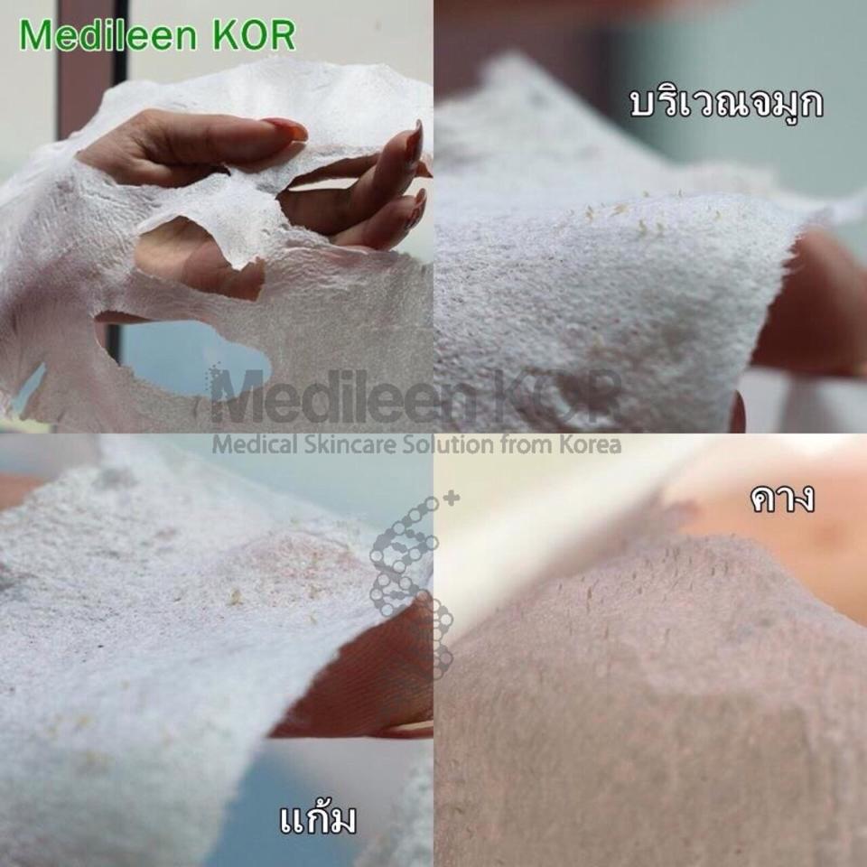 Medileen kor Chitosan Facial Mask ขับสารผิดที่ตกค้างบนผิว ช่วยดูดสิว กระตุ้นการผลัดเซลล์ผิวที่ตายแล้วให้หลุด ราคา 950 บาท