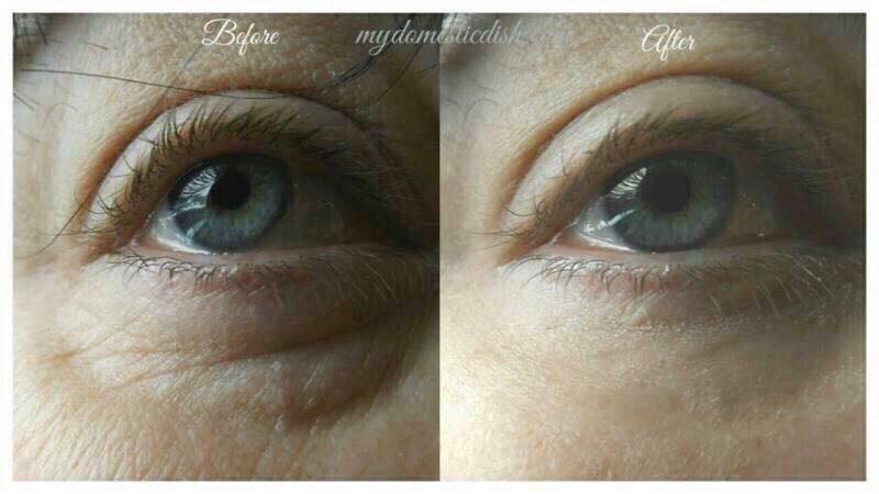 Instantly Ageless อินสแตนลี่ เอจเลส