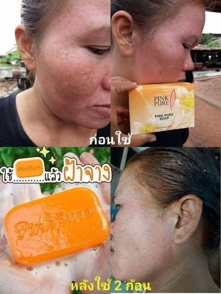 Pink Pure Soap สบู่พิงค์เพียว