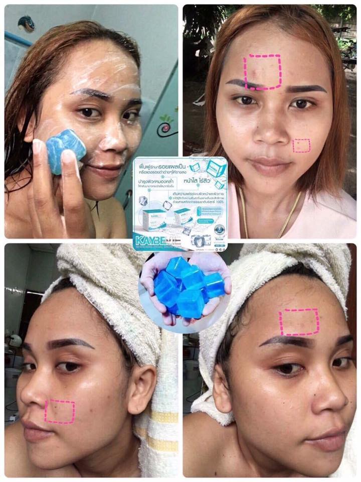 สบู่เคบีวี่ Kaybevie Soap สบู่น้ำแร่จากแบรนด์ Kaybee