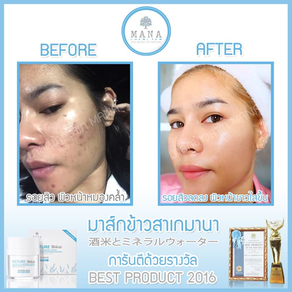 มาส์กข้าวสาเก MANA สุดฮอต!!