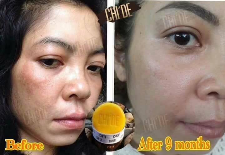 สบู่ Chi’de 120 g. สบู่ขึ้นเงา ราชินีแห่งผิว