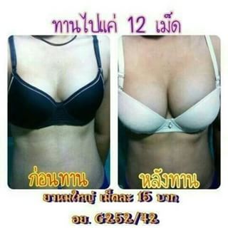 ยานมชมพูสูตรแรง ยานมโต ยานมคลินิก ยานมใหญ่ ยาอกใหญ่ ยานมใหญ่ตัวหอม ขยายหน้าอก อกอึ๋ม ยานมโตอกอึ๋ม เพิ่มอก เพิ่มนม สูตร 2 สอง สีชมพู ยานมกระเทย กลิ่นตัวหอมเย้ายวน น้องสาวฟิตกระชับ แนะนำ ยานม by JAR Si.Ka ยาเพิ่มขนาดทรวงอก ยานมโต ยานมใหญ่ ยานมชิด ยาอัฟไซด์น