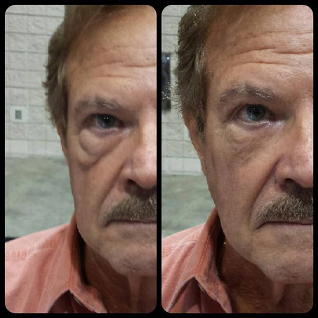 Instantly Ageless อินสแตนลี่ เอจเลส