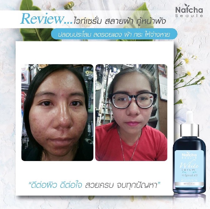 เซรั่มณัชชา รีวิว เซรั่มณัชชา รีวิว