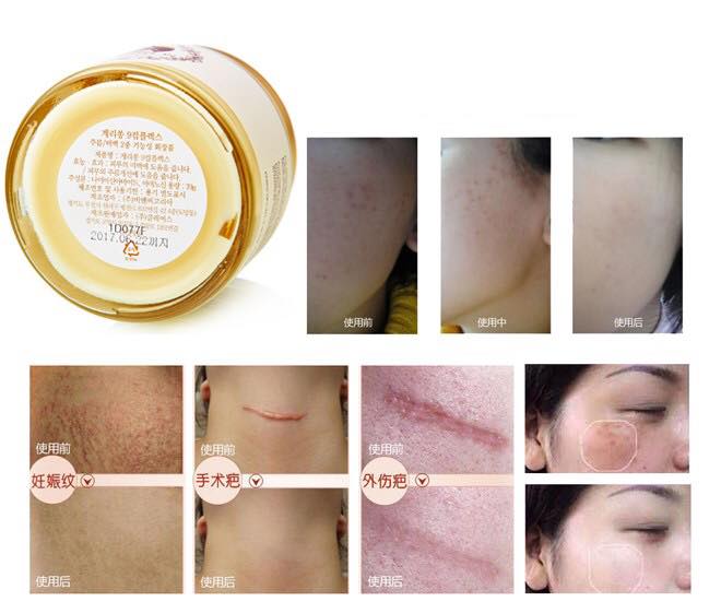 Guerisson 9-Complex Basic Set เซทครีมน้ำมันม้า