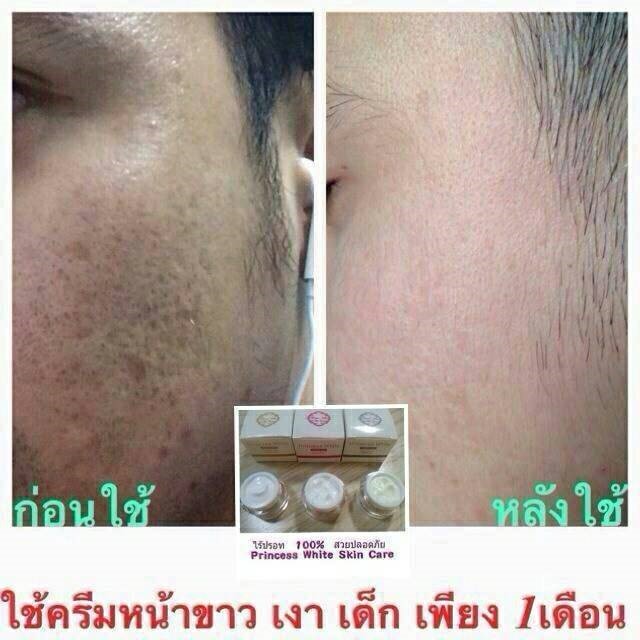 ครีมหน้าขาว หน้าเงา หน้าเด็ก Princess white