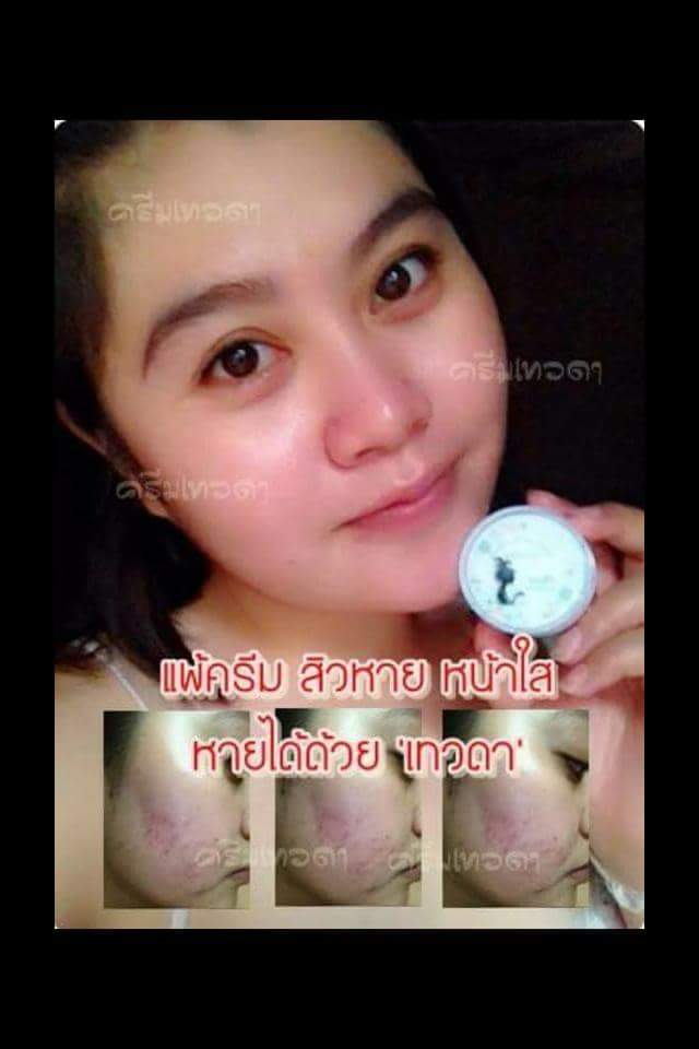 Night Angel Cream Plus Whitening 10 g. ครีมเทวดา ลดสิว ลดริ้วรอย ลดฝ้า กระ จุดด่างดำ