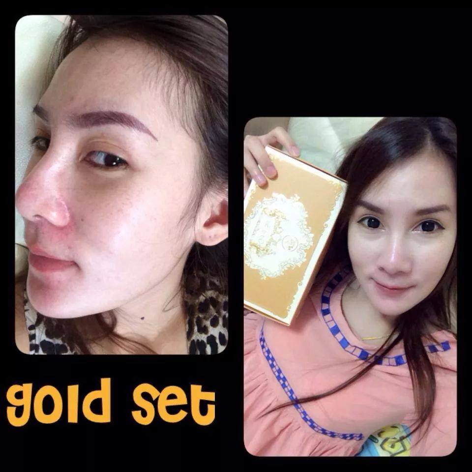 Freshy Face Gold Set ครีมชุดถุงทอง