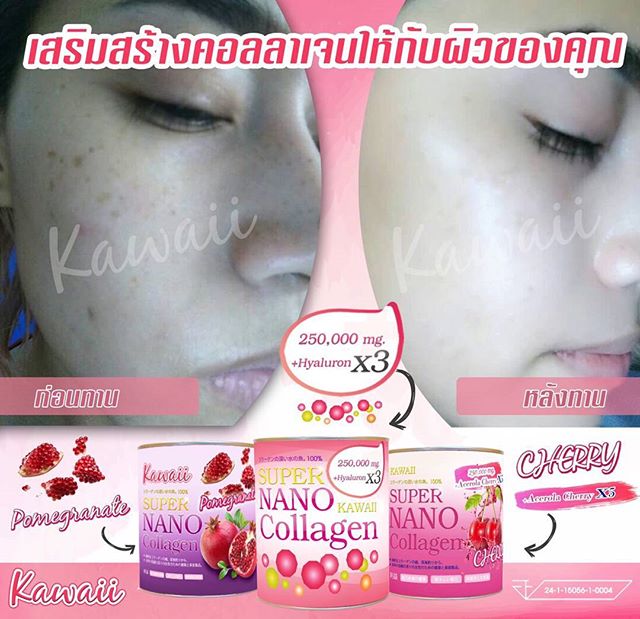 Kawaii Super Nano Collagen Pomegranate ซุปเปอร์ นาโน คอลลาเจน รสทับทิม ขาวใส ไม่กลัวแดด – แบบซอง