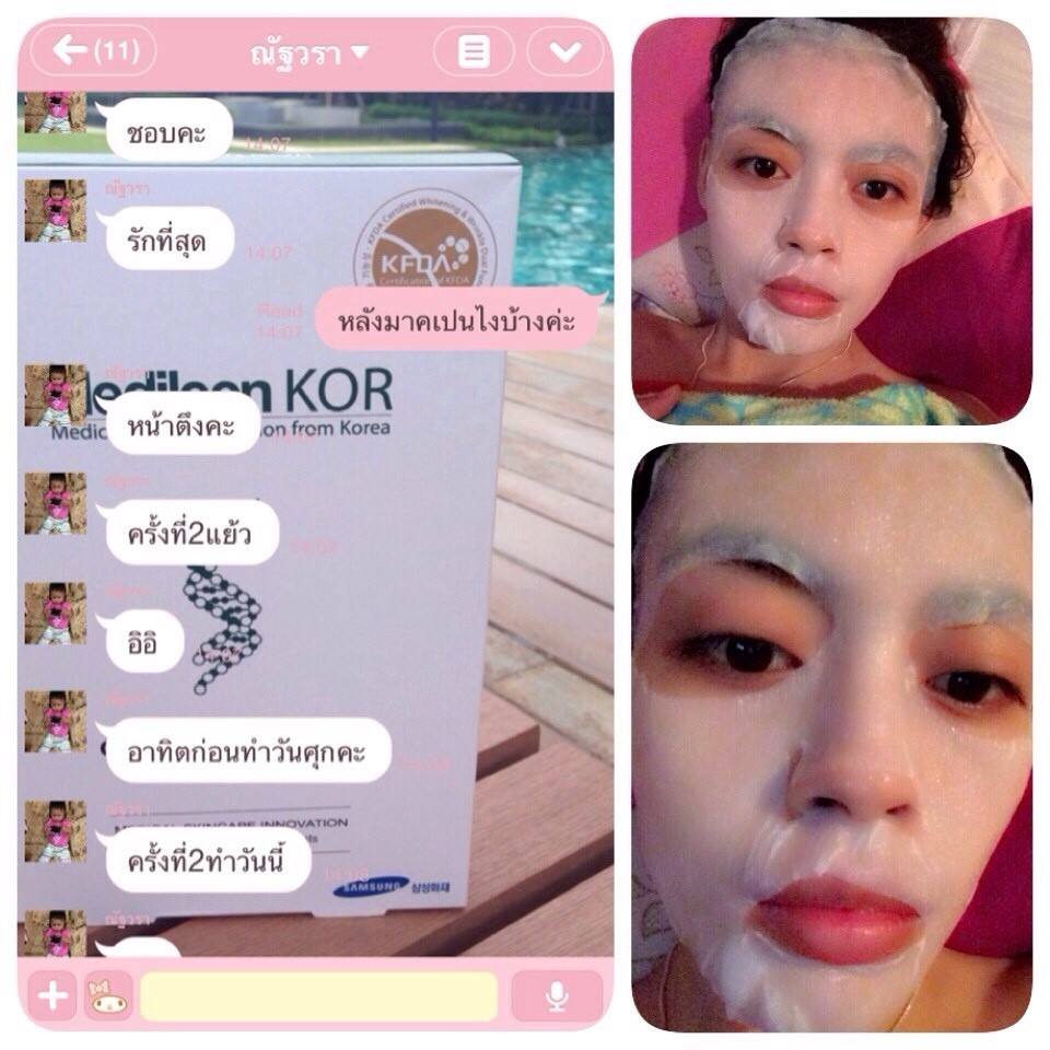 Medileen kor Chitosan Facial Mask ขับสารผิดที่ตกค้างบนผิว ช่วยดูดสิว กระตุ้นการผลัดเซลล์ผิวที่ตายแล้วให้หลุด ราคา 950 บาท