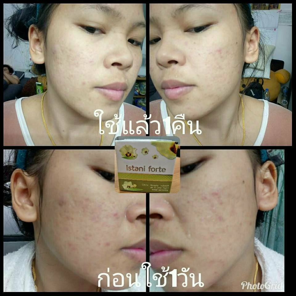 Istani Forte อิสทานี่ ฟอเต้ ครีมกระเจี๊ยบเขียว สัมผัสใหม่