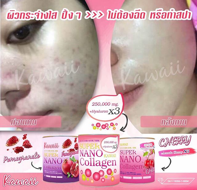 Kawaii Super Nano Collagen Pomegranate ซุปเปอร์ นาโน คอลลาเจน รสทับทิม ขาวใส ไม่กลัวแดด – แบบซอง