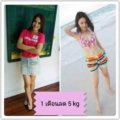 ยาลดน้ำหนักคลีนิคชุดลดน้ำหนักดื้อยา ระดับ 3 ได้ผลดี เผาผลาญดีเยี่ยม คลินิค รพ.ชั้นนำนิยมใช้เคสพิเศษ... ราคาชุดละ 350 บาท