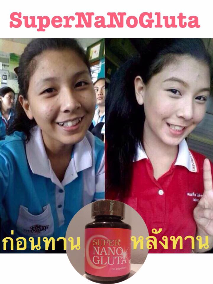 ซุปเปอร์นาโนกลูต้า (Super Nano Gluta)