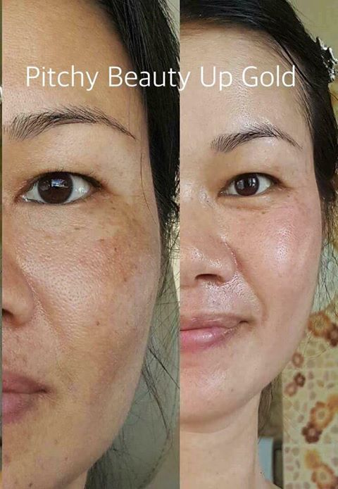 พิชชี่บิวตี้อัพโกลด์เซท (Pitchy Beauty Up Gold Set) แพคเกจใหม่