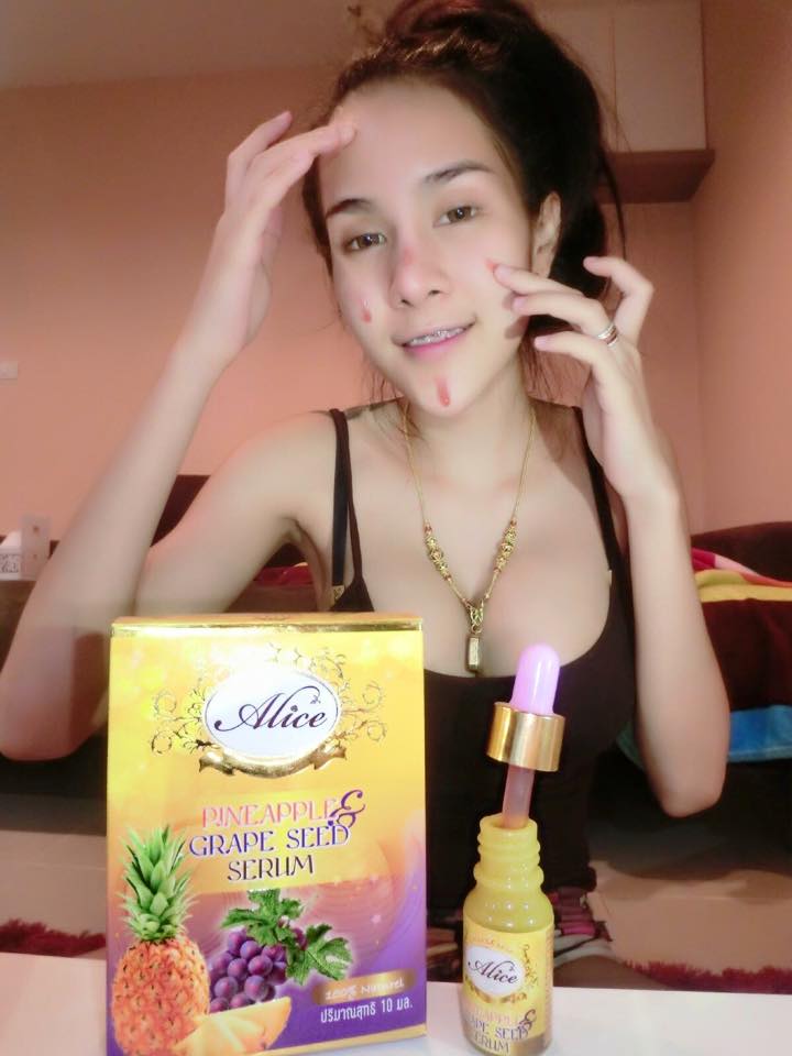 Alice เซรั่มสับปะรด เม็ดองุ่น Pineapple Grape Serum by Alice