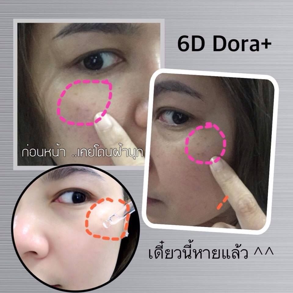 Product details of 6D Dora+ โทนเนอร์สลาย ฝ้า กระ 10 กรัม ( 1ขวด ) ราคา 370 บาท