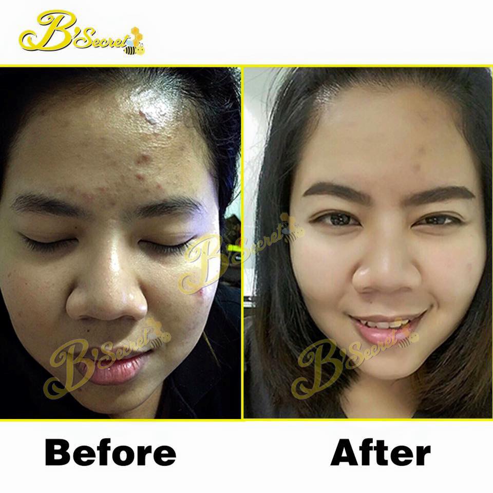 Forest Honey Bee Cream By B'secret 15 g. ครีมน้ำผึ้งป่า ศาสตร์แห่งการฟื้นฟูบำรุงผิวที่ดีที่สุด