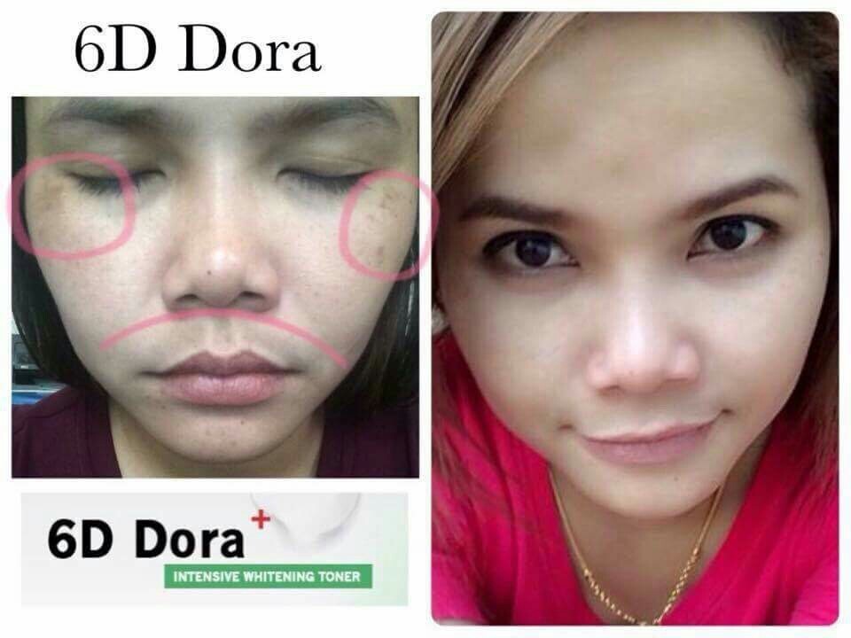 Product details of 6D Dora+ โทนเนอร์สลาย ฝ้า กระ 10 กรัม ( 1ขวด ) ราคา 370 บาท