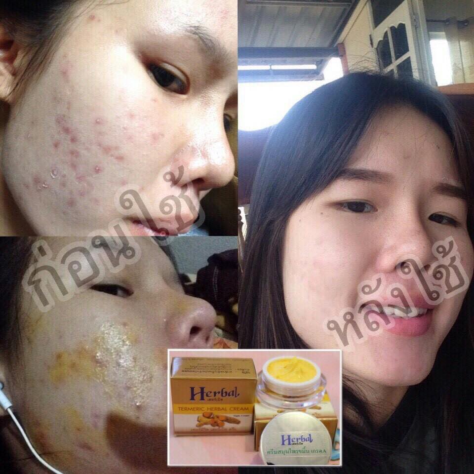 Termeric Herbal Cream Night Cream 5 g. เทอร์มิริค เฮอร์เบิล ครีม ครีมขมิ้นบำรุงผิวหน้า
