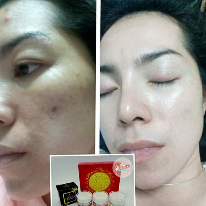ครีมหน้าขาว หน้าเงา หน้าเด็ก