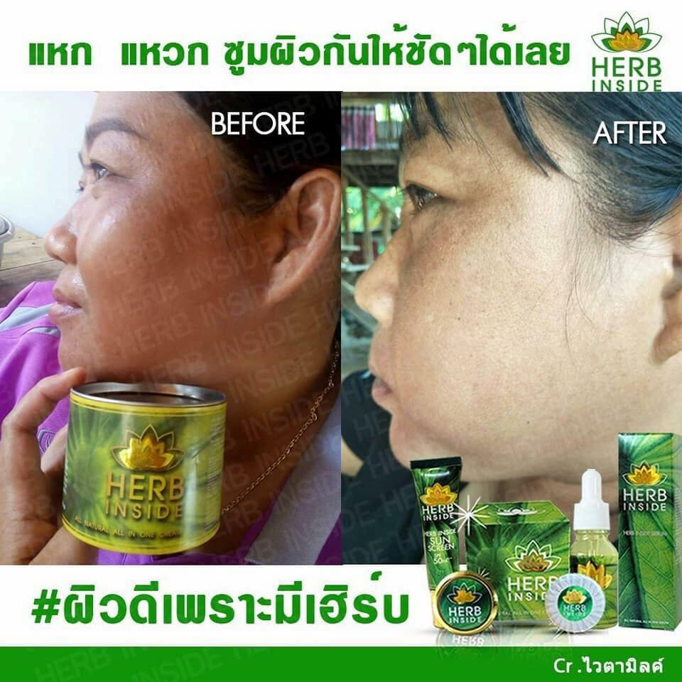 Herb Gold Big Size By Herb Inside เฮิร์บ อินไซด์ ชุดใหญ่
