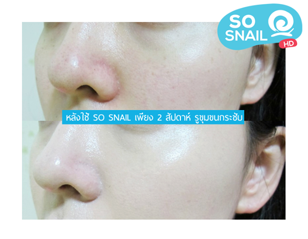 So Snail HD 30 ml. โซ สเนล เอชดี ครีมหน้าเงา หน้าใส