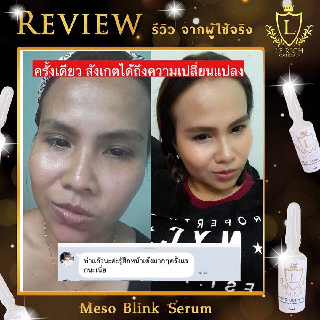 MESO BLINK SET LERICH เมโส สะกิดหน้าใส แก้ทุกปัญหา