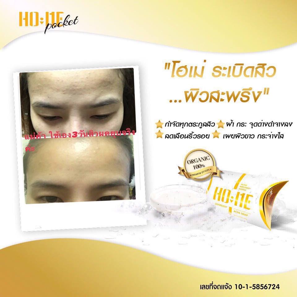 Ho-Me Acne Soap 30 g. โฮเม่ แอคเน่ โซพ สบู่สมุนไพรทุเรียนเทศ เปลี่ยนหน้าสิว ให้ใส