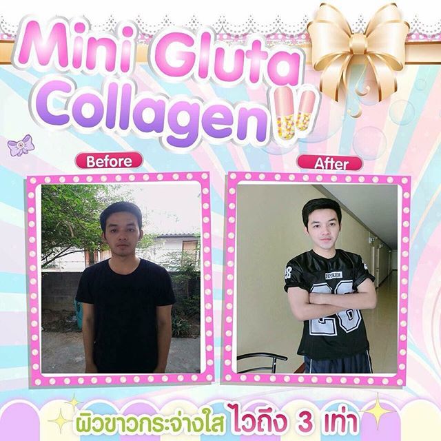 Mini Gluta Collagen ( สูตร ผิวขาว + ลดสิว )