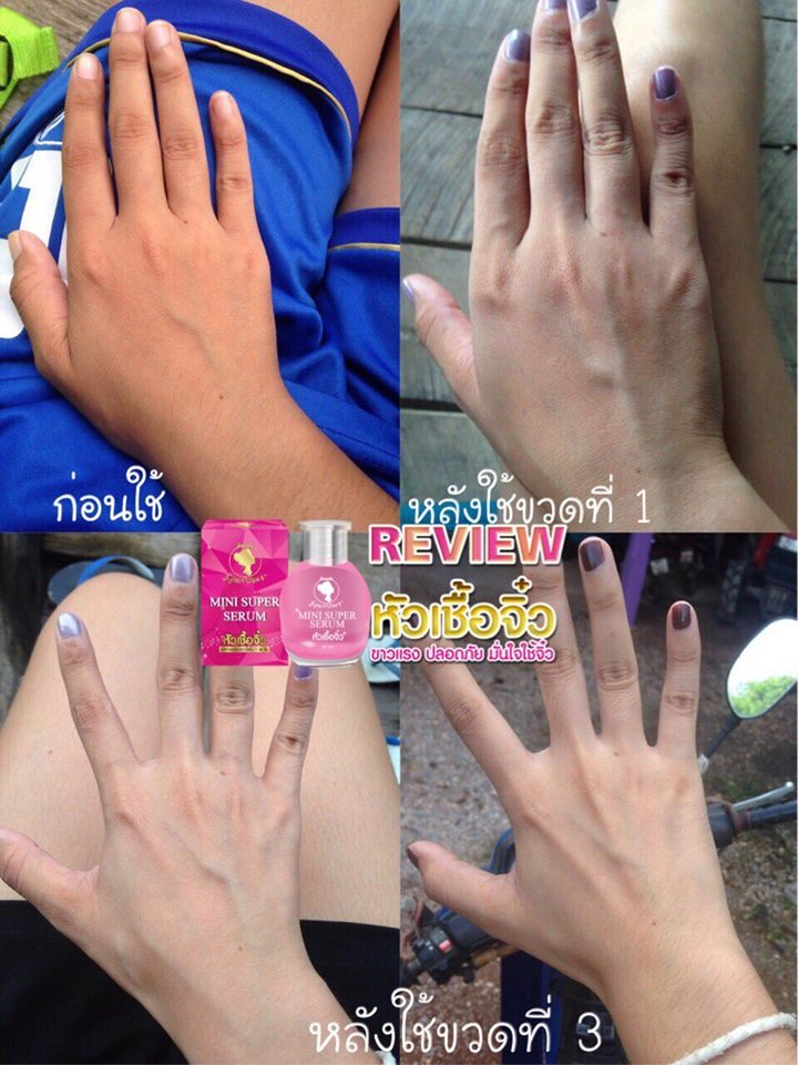 Mini Super Serum หัวเชื้อจิ๋ว by Khun Chan 30 ml. หยุดวงจรความดำ ขาวใสใน 7 วัน