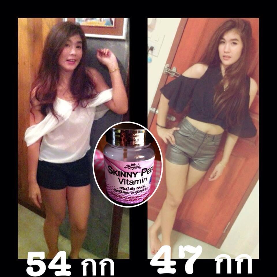 Skinny Peel Vitamin วิตามิน ลดแขน ลดขา ใบหน้าเรียวสวย