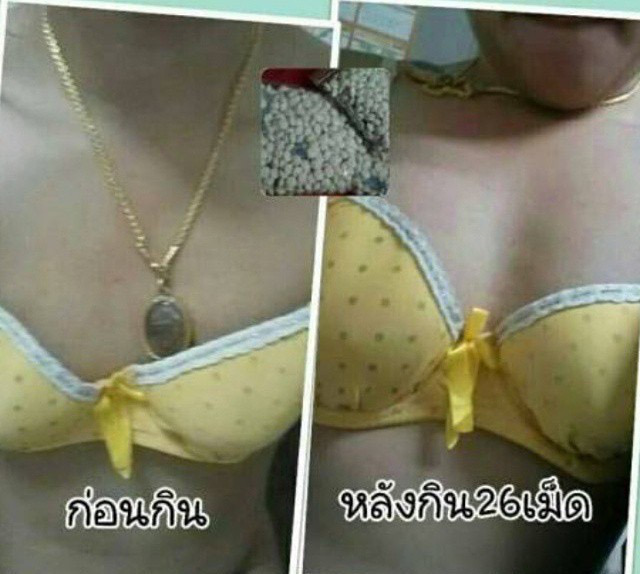 ยานมชมพูสูตรแรง ยานมโต ยานมคลินิก ยานมใหญ่ ยาอกใหญ่ ยานมใหญ่ตัวหอม ขยายหน้าอก อกอึ๋ม ยานมโตอกอึ๋ม เพิ่มอก เพิ่มนม สูตร 2 สอง สีชมพู ยานมกระเทย กลิ่นตัวหอมเย้ายวน น้องสาวฟิตกระชับ แนะนำ ยานม by JAR Si.Ka ยาเพิ่มขนาดทรวงอก ยานมโต ยานมใหญ่ ยานมชิด ยาอัฟไซด์น