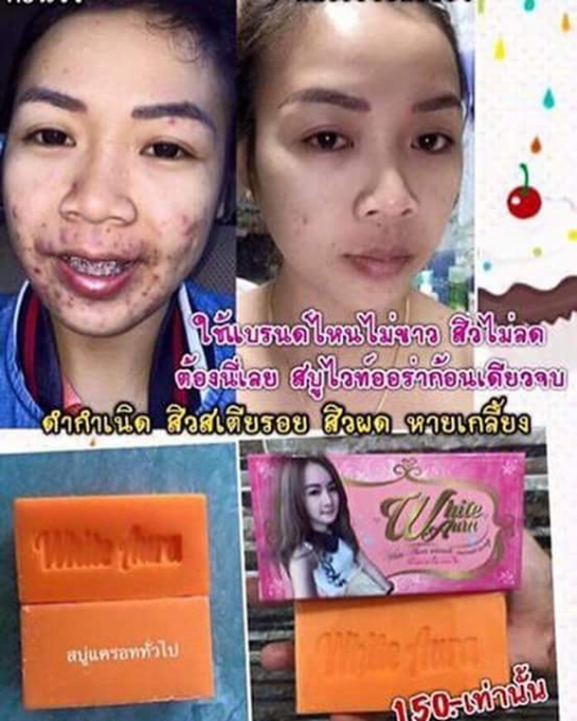 สบู่ไวท์ออร่า (White aura miracle carrot soap)