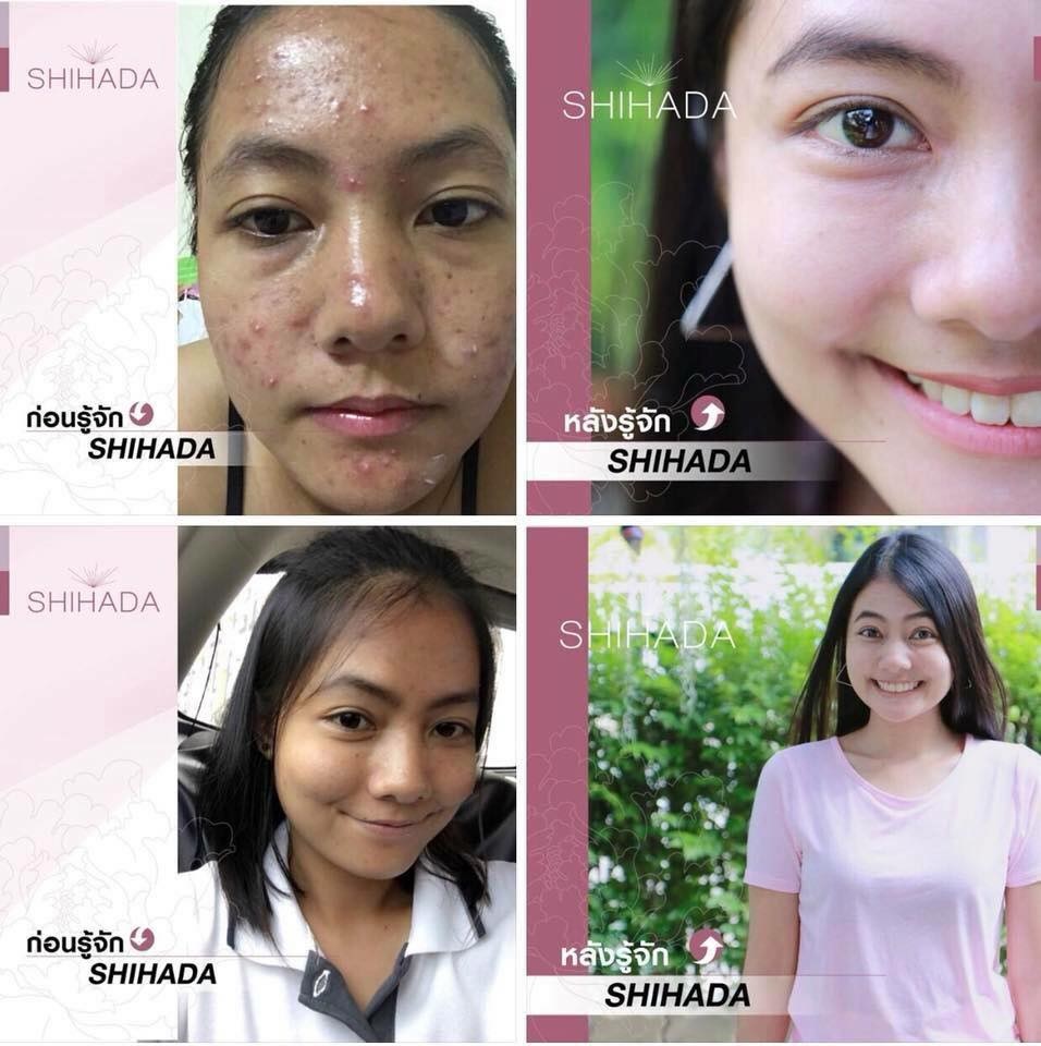 GLUTA SHIHADA รีวิว กลูต้าชิฮาดะ รีวิว