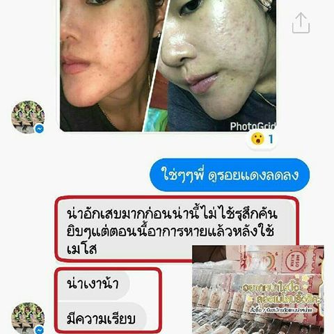 MESO BLINK SET LERICH เมโส สะกิดหน้าใส แก้ทุกปัญหา