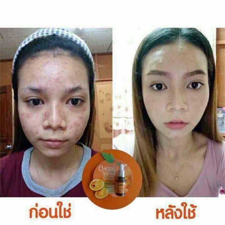 C-Kiss Vit-C Serum เซรั่มหน้าใส