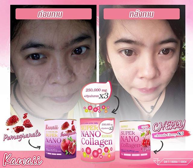 Kawaii Super Nano Collagen Pomegranate ซุปเปอร์ นาโน คอลลาเจน รสทับทิม ขาวใส ไม่กลัวแดด – แบบซอง