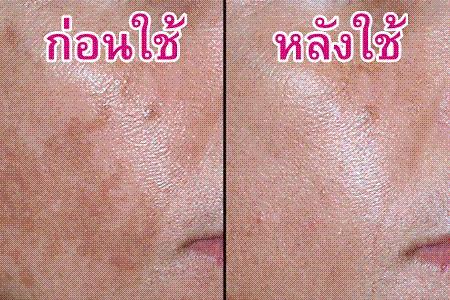 ครีมเหมยหยง สมุนไพรสาหร่าย 3 ชิ้น ของแท้!!!