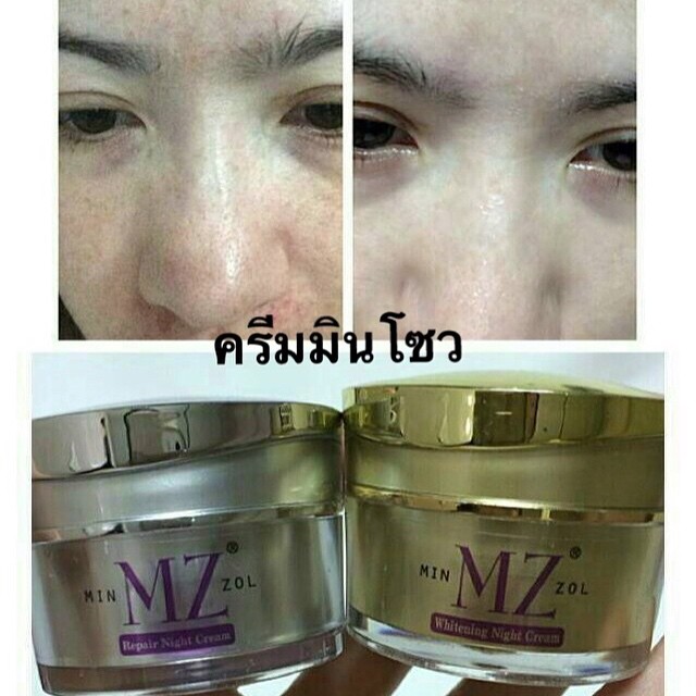 Minzol Cream ครีมมินโซว ราคา 450 บาท Line : fujimate