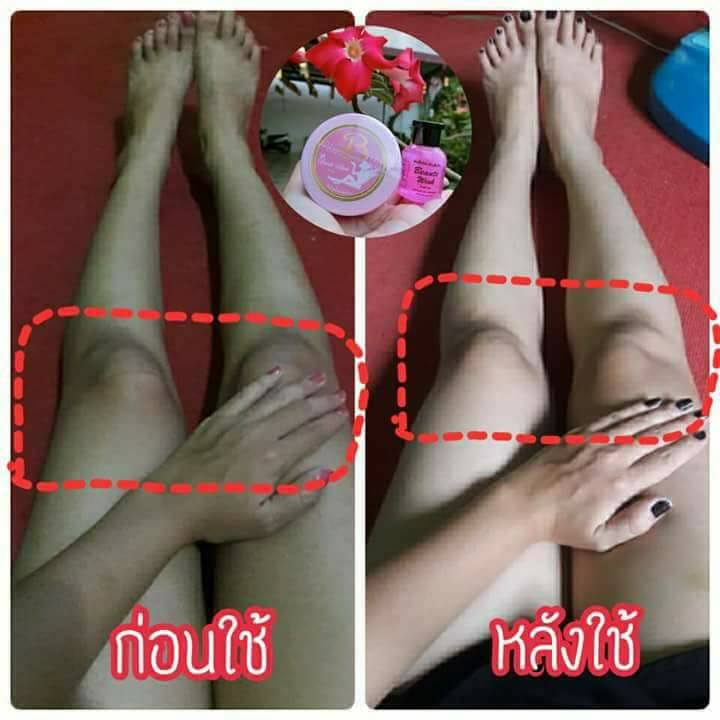 Beute Wing หัวเชื้อโบเต้ วิ้งค์
