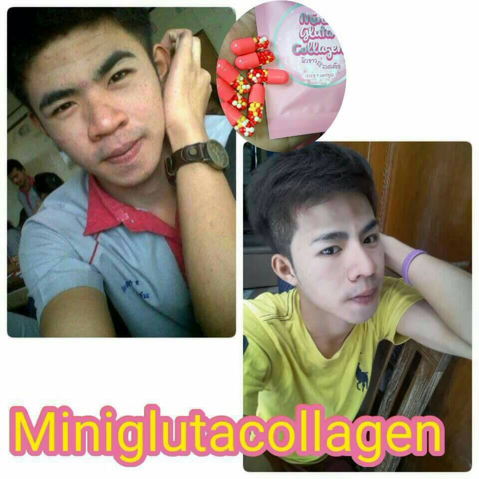 Mini Gluta Collagen ( สูตร ผิวขาว + ลดสิว )