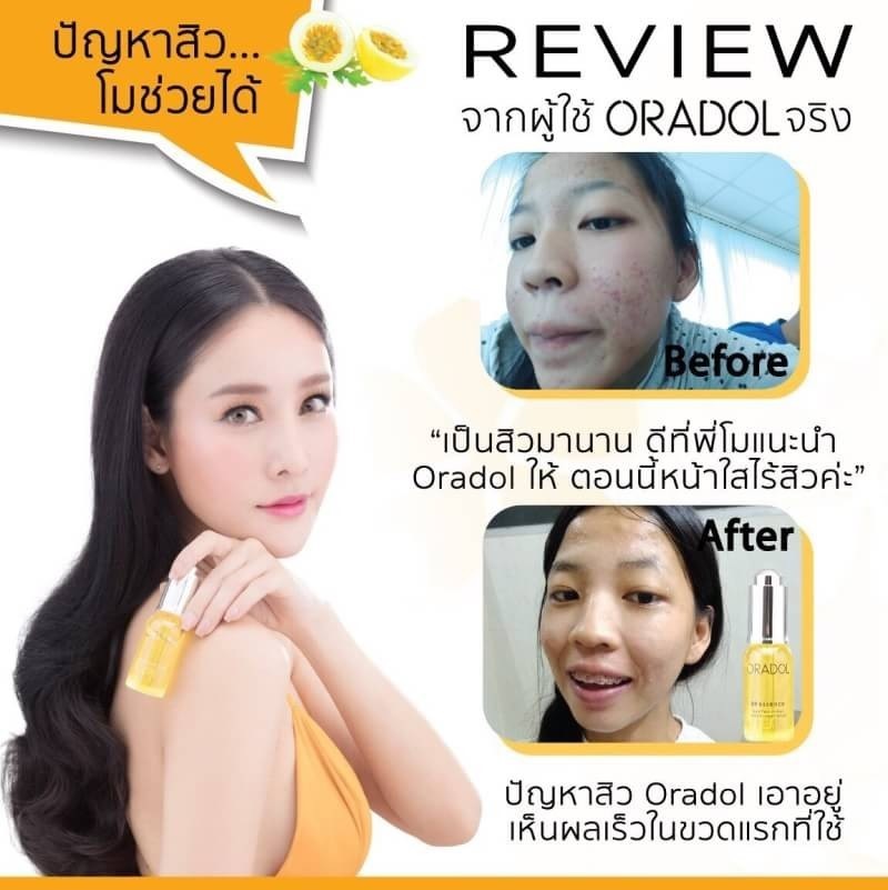 Oradol G9 Essence serum รีวิว