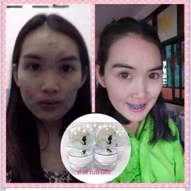 Night Angel Cream Plus Whitening 10 g. ครีมเทวดา ลดสิว ลดริ้วรอย ลดฝ้า กระ จุดด่างดำ