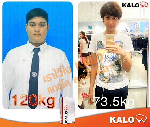 ผลิตภัณฑ์ อาหารเสริม KALOW ลดน้ำหนัก กิ้บซี่ KALO แกลโล (คาโล) ราคา 990 บาท