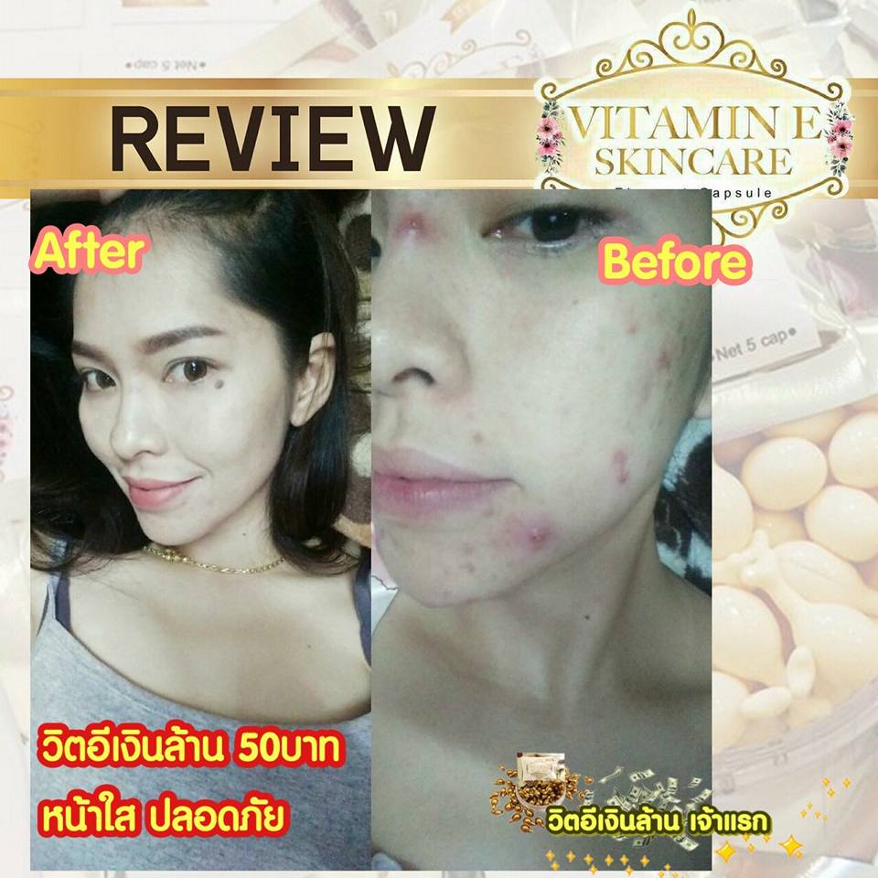 วิตามินอี บำรุงผิวหน้า Vitamin E Skincare by Nifty