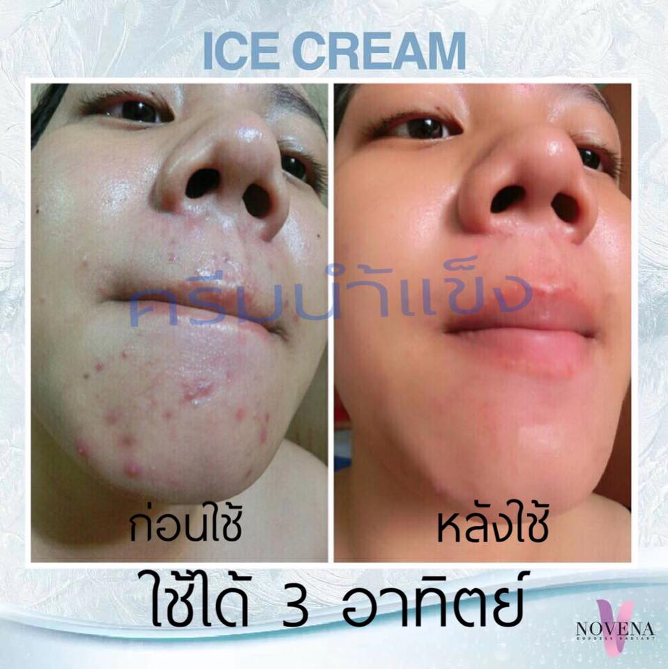 Ice Sleeping Cream ครีมน้ำแข็ง สำหรับกลางคืน