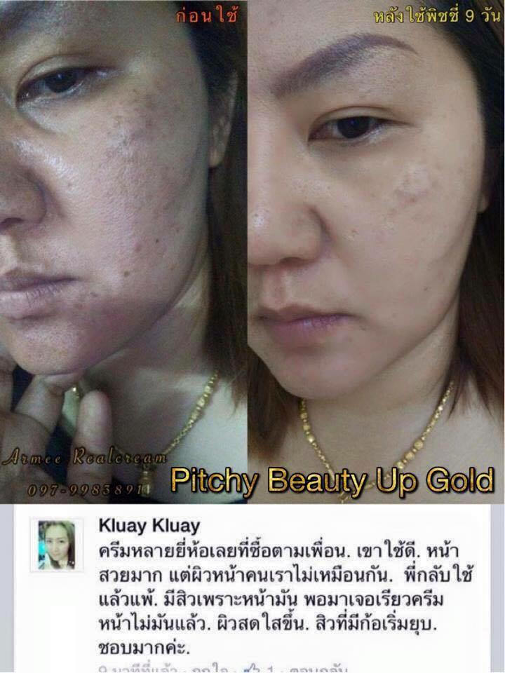 พิชชี่บิวตี้อัพโกลด์เซท (Pitchy Beauty Up Gold Set) แพคเกจใหม่